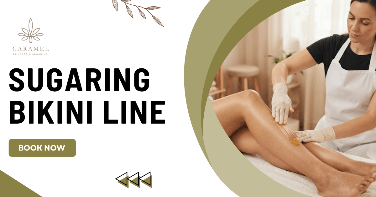 Sugaring Bikini Line